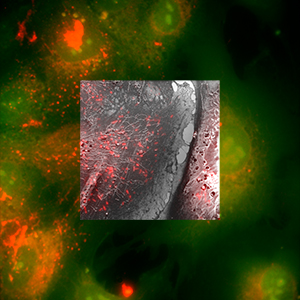 DELMIC secom overlay fluorescence microscopy and SEM