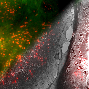 DELMIC secom overlay fluorescence microscopy and SEM