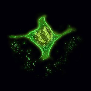 lice cell imaging using fluorescence and holographic tomography