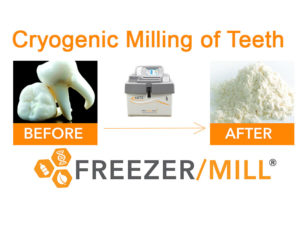 Cryogenic grinding of teeth