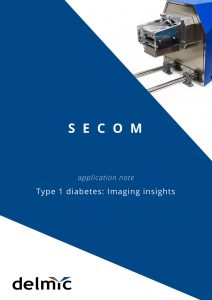 Type 1 diabetes imaged using Delmic SECOM