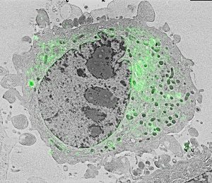 Delmic SECOM SR super resolution CLEM HeLa cell image