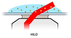 HILO - Oxford Nanoimager