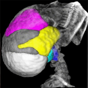 invicro VivoQuant medical imaging analysis software