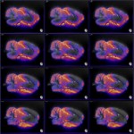 invicro VivoQuant medical imaging analysis software