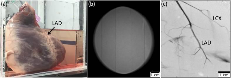 Angiography using Lyncean compact light source