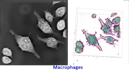 cells imaged using 3DCX