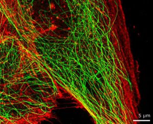 Nanoimager dual colour super resolution image