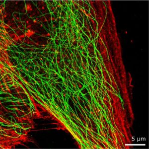 Nanoimager dual colour super resolution image