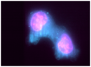 Oxford Nanoimaging exosomes microvessicles