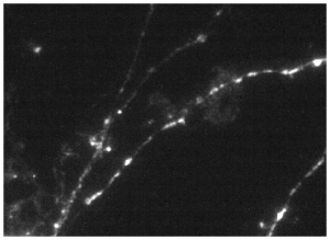 Oxford Nanoimaging neuronal imaging