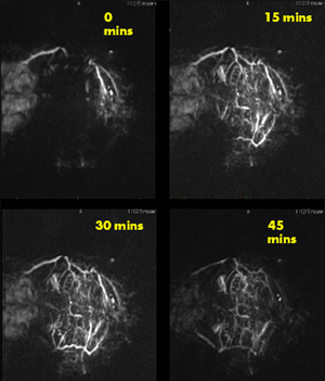 Photoacoustic CT imaging