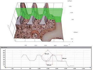 Hirox RH-2000 3D Digital Microscope 3D profile