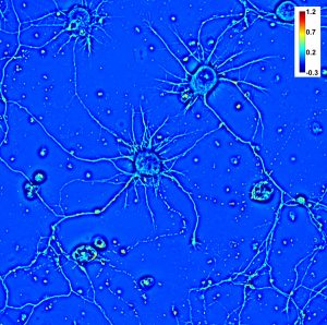 SLIM image of rat hippocampal neurons (40x 0.65NA objective).