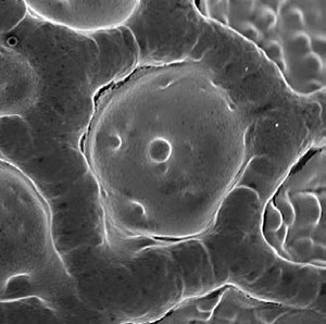Life science application of the TESCAN XEIA ultra-high resolution SEM with Xe Plasma FIB