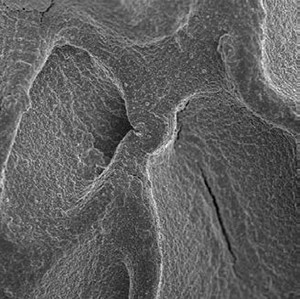 Life science application of the TESCAN XEIA ultra-high resolution SEM with Xe Plasma FIB