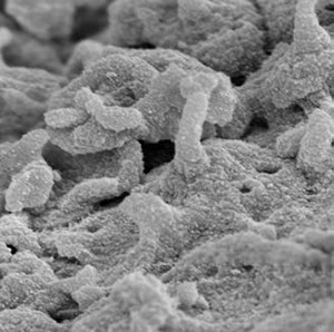 Life science application of the TESCAN XEIA ultra-high resolution SEM with Xe Plasma FIB