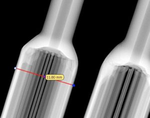 XRIS Dereo digital radiography