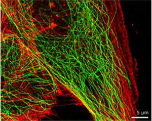 dual colour imaging - Oxford Nanoimager