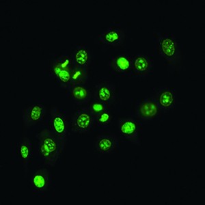 TESCAN Q-Phase Multimodal Holographic Microscope image of human prostate cancer cells