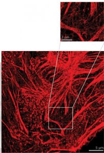 Super Resolution Imaging - Oxford Nanoimager